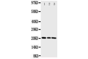 Western Blotting (WB) image for anti-Phosphatidylethanolamine Binding Protein 1 (PEBP1) (AA 15-29), (N-Term) antibody (ABIN3044276) (PEBP1 antibody  (N-Term))