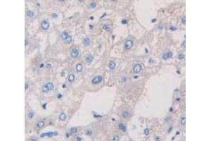 IHC-P analysis of Human Tissue, with DAB staining. (TRPA1 antibody  (AA 63-370))