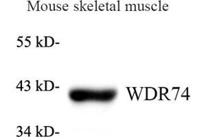 Western blot analysis of WDR74 (ABIN7076220) at dilution of 1: 1000 (WDR74 antibody)