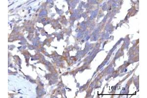 IHC analysis of RAP1GAP using anti-RAP1GAP antibody (ABIN7599729). (RAP1GAP antibody  (AA 11-661))