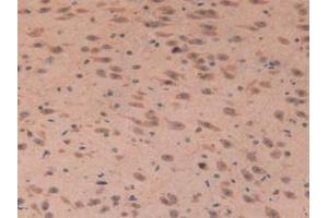 IHC-P analysis of Mouse Brain Tissue, with DAB staining. (IGFBP7 antibody  (AA 88-281))