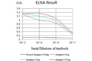Black line: Control Antigen (100 ng),Purple line: Antigen (10 ng), Blue line: Antigen (50 ng), Red line:Antigen (100 ng) (FCAR antibody  (AA 22-227))