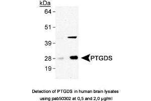 Image no. 1 for anti-Prostaglandin D2 Synthase (PTGDS) antibody (ABIN363611) (PTGDS antibody)