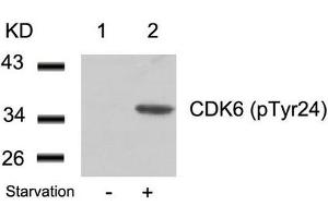 Western blot analysis of extracts from 293 cells untreated(lane 1) or treated with starvation(lane 2) using CDK6(phospho-Tyr24) Antibody. (CDK6 antibody  (pTyr24))