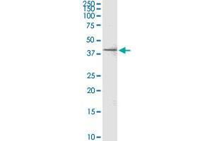 C20orf77 monoclonal antibody (M04), clone 4D6. (RPRD1B antibody  (AA 1-326))