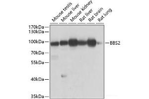 Western blot analysis of extracts of various cell lines using BBS2 Polyclonal Antibody at dilution of 1:1000. (BBS2 antibody)