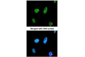 ICC/IF Image Immunofluorescence analysis of paraformaldehyde-fixed HeLa, using TATDN1, antibody at 1:200 dilution. (TATDN1 antibody  (Center))