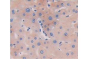 Used in DAB staining on fromalin fixed paraffin- embedded liver tissue (Biliverdin Reductase antibody  (AA 1-125))