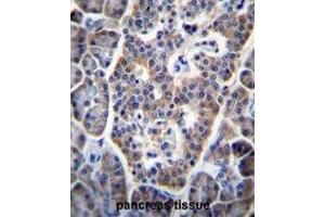 TP53INP1 Antibody (C-term) immunohistochemistry analysis in formalin fixed and paraffin embedded human pancreas tissue followed by peroxidase conjugation of the secondary antibody and DAB staining.