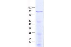 Validation with Western Blot (SYTL4 Protein (His tag))