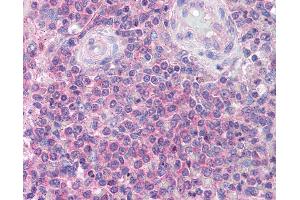Anti-IRAK4 antibody IHC of human spleen. (IRAK4 antibody  (C-Term))