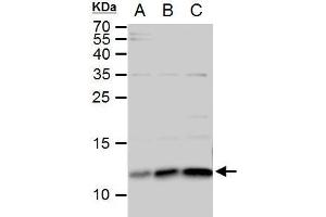 WB Image ERH antibody detects ERH protein by western blot analysis.
