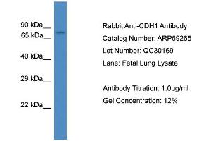 WB Suggested Anti-CDH1  Antibody Titration: 0. (E-cadherin antibody  (Middle Region))