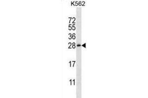 Western Blotting (WB) image for anti-Chorionic Somatomammotropin Hormone-Like 1 (CSHL1) antibody (ABIN2997108)