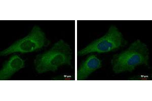 ICC/IF Image MUC2 antibody [C3], C-term detects MUC2 protein at cytoplasm by immunofluorescent analysis.