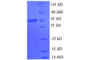 Spermidine/spermine N1-Acetyltransferase 1 (SAT1) (AA 5-171) protein (GST tag) (SAT1 Protein (AA 5-171) (GST tag))
