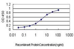 Detection limit for recombinant GST tagged PGR is approximately 0. (Progesterone Receptor antibody  (AA 1-110))