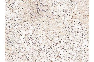 Immunohistochemistry of Goat Anti-GRK2 Antibody Immunohistochemistry of Goat Anti-GRK2 Antibody. (GRK2 antibody  (C-Term))