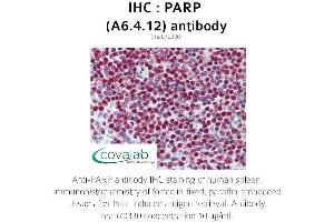 Image no. 3 for anti-Poly (ADP-Ribose) Polymerase 1 (PARP1) antibody (ABIN1723251) (PARP1 antibody)