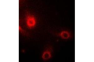 Immunofluorescent analysis of Aminoacylase 1 staining in Hela cells. (Aminoacylase 1 antibody)