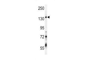 GPRASP1 Antibody (C-term) (ABIN652013 and ABIN2840496) western blot analysis in Jurkat cell line lysates (35 μg/lane). (GPRASP1 antibody  (C-Term))
