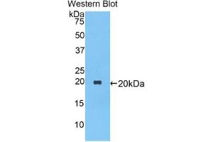 Detection of Recombinant a1AT, Rat using Polyclonal Antibody to Alpha-1-Antitrypsin (a1AT) (SERPINA1 antibody  (AA 27-181))