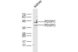 Mouse kidney lysates probed with Rabbit Anti-PDGFC Polyclonal Antibody, Unconjugated  at 1:500 for 90 min at 37˚C.