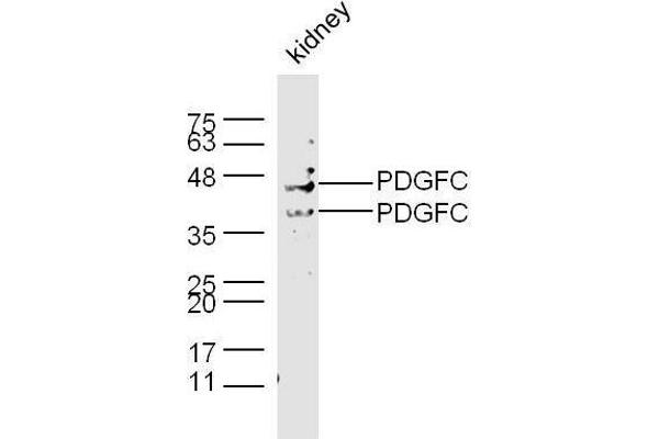 PDGFC antibody  (AA 201-300)