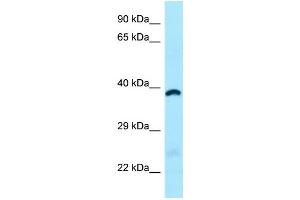 WB Suggested Anti-ABHD6 Antibody Titration: 1. (ABHD6 antibody  (C-Term))