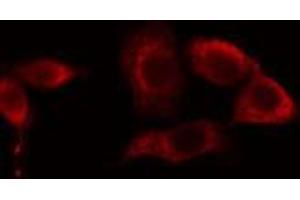 ABIN6274656 staining LOVO cells by IF/ICC.