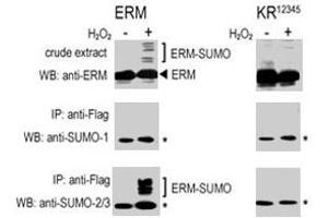 COS-7 cells were transfected for 24 hrs with a plasmid expressing FLAG-ERM (left panels) or FLAG-ERM KR12345 (right panels) . (SUMO1 antibody  (C-Term))