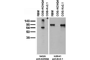 Adult rat brain membrane (RBM) and transfected cell immunoblot: extracts of RBM (left lane) and COS-1 cells transiently transfected with KCNQ4 (middle lane) or Kv2.