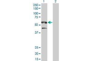 Western Blot analysis of SH2B1 expression in transfected 293T cell line by SH2B1 monoclonal antibody (M01), clone 2B9. (SH2B1 antibody  (AA 327-426))