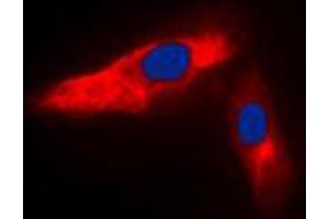 Immunofluorescent analysis of ACTN3 staining in HeLa cells. (ACTN3 antibody  (N-Term))