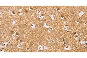 Immunohistochemistry of paraffin-embedded Human brain tissue using ARHGEF1 Polyclonal Antibody at dilution 1:50 (ARHGEF1 antibody)
