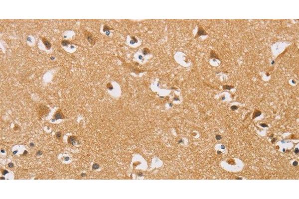 ARHGEF1 antibody