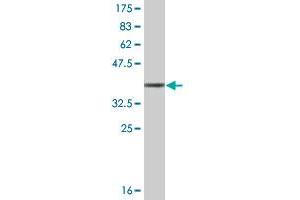 Western Blot detection against Immunogen (36. (TNNT3 antibody  (AA 161-258))
