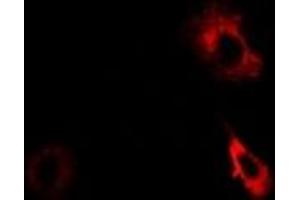 Immunofluorescent analysis of AKR7A2 staining in Hela cells. (AKR7A2 antibody)
