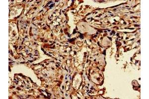 Immunohistochemistry of paraffin-embedded human placenta tissue using ABIN7172536 at dilution of 1:100 (TFEB antibody  (AA 1-476))