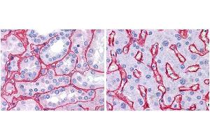 anti collagen IV antibody (600-401-106 Lot 25440, 1:400, 45 min RT) showed strong staining in FFPE sections of human kidney (Left) with strong red staining observed in glomeruli and liver (Right) with strong staining in sinusoids.
