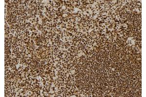 ABIN6278728 at 1/100 staining Mouse spleen tissue by IHC-P. (ERCC6 antibody  (Internal Region))