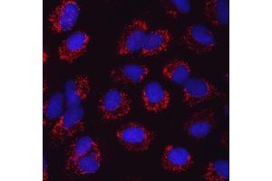 IF analysis of SARS2 using anti-SARS2 antibody (ABIN7601804). (SARS2 antibody  (AA 46-518))