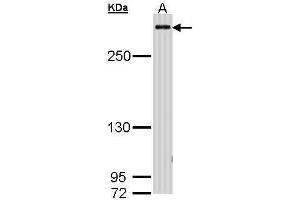 WB Image Sample (30 ug of whole cell lysate) A: H1299 5% SDS PAGE antibody diluted at 1:1000 (CBP antibody  (C-Term))