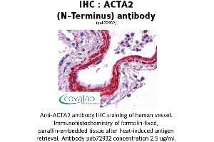 Image no. 1 for anti-Actin, alpha 2, Smooth Muscle, Aorta (ACTA2) (N-Term) antibody (ABIN1731470)