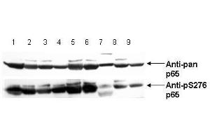 Image no. 4 for anti-Nuclear Factor-kB p65 (NFkBP65) (pSer276) antibody (ABIN1103942) (NF-kB p65 antibody  (pSer276))