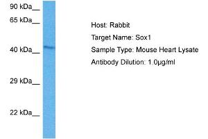Host: Mouse Target Name: SOX1 Sample Tissue: Mouse Heart Antibody Dilution: 1ug/ml (SOX1 antibody  (Middle Region))