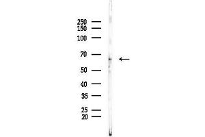 anti-Dihydropyrimidinase-Like 2 (DPYSL2) (C-Term) antibody