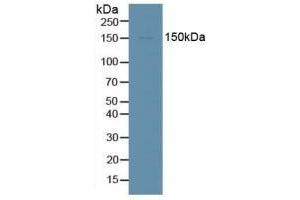Detection of DDX58 in Human HepG2 Cells using Polyclonal Antibody to Probable ATP-dependent RNA Helicase DDX58 (DDX58) (DDX58 antibody  (AA 1-211))