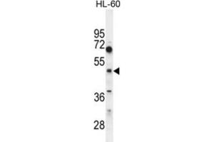 Western Blotting (WB) image for anti-Choline/ethanolamine phosphotransferase 1 (CEPT1) antibody (ABIN2995621) (CEPT1 antibody)