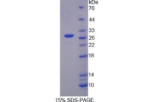 Image no. 1 for Myosin Light Chain Kinase 2 (MYLK2) (AA 330-548) protein (His tag) (ABIN4989827)